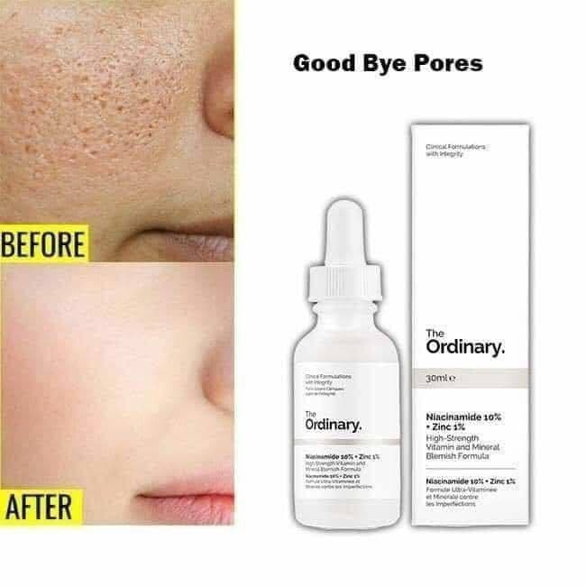 سيرم اورديناري نياسيناميد