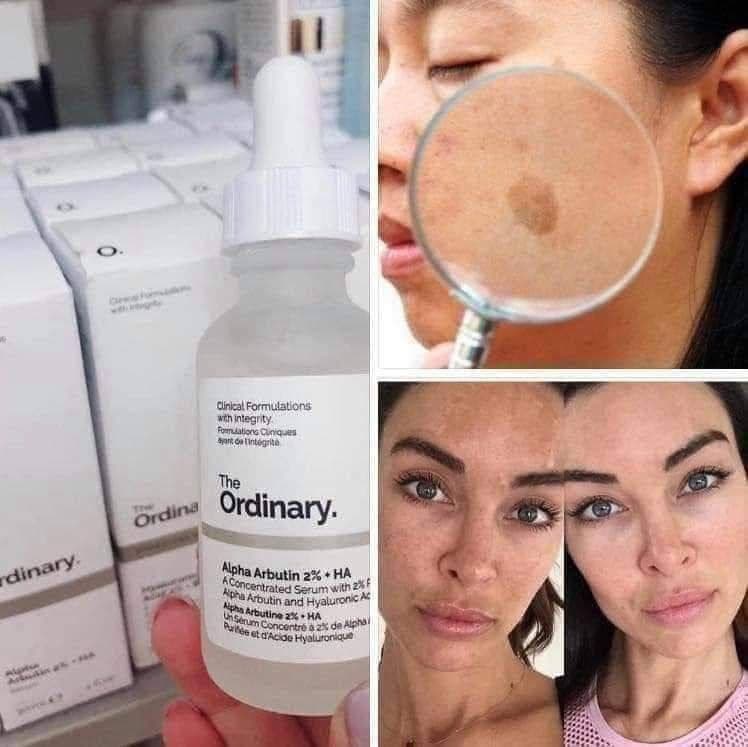 سيرم ذا اورديناري ألفا اربيوتين
